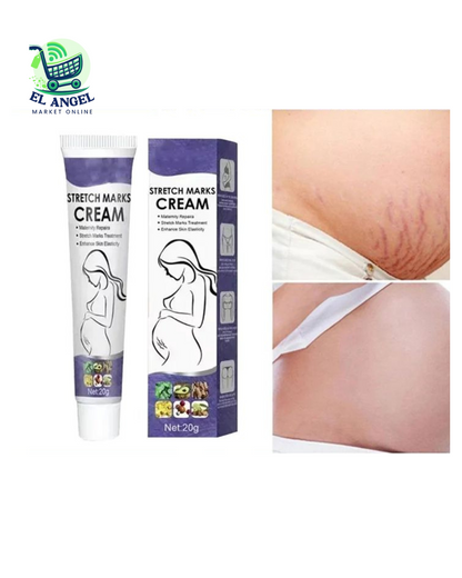STRETCH MARK CREAM- ELIMINADOR DE ESTRIAS